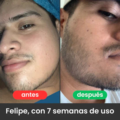 Bálsamo para Crecimiento de Barba Ultra Potente con Minoxidil 20% | 100mL 👊